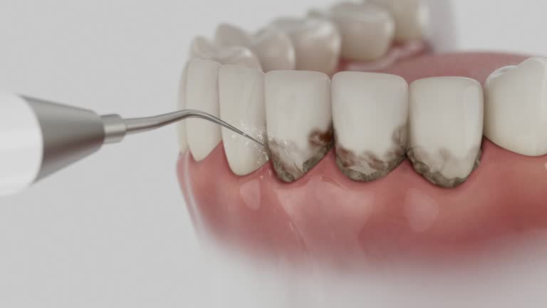 Trusted Tooth Extraction service in Dock Junction, GA - Dentist Open Now